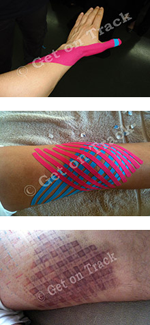 Kinesio-Medical Taping